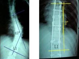 脊柱凹凸图片欧美,探寻人体结构的独特魅力